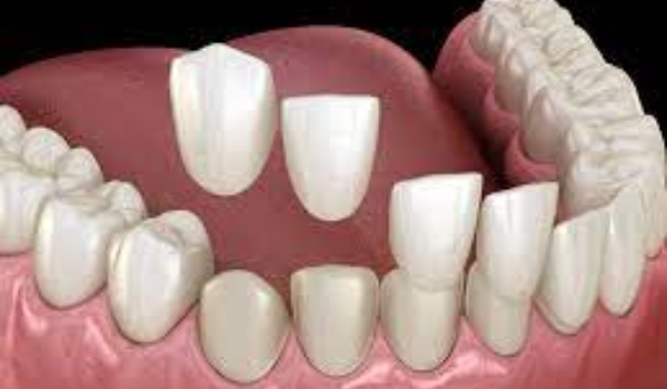 Prosthodontics